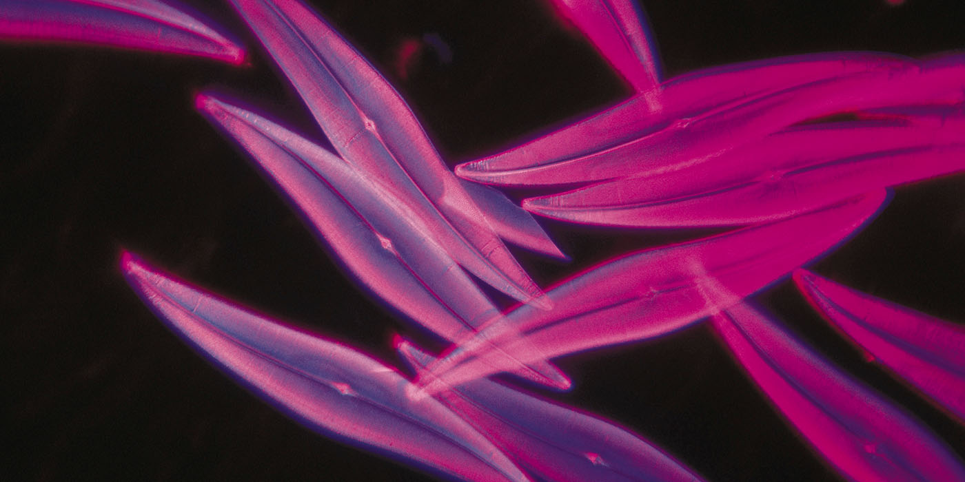 close up of phytoplankton